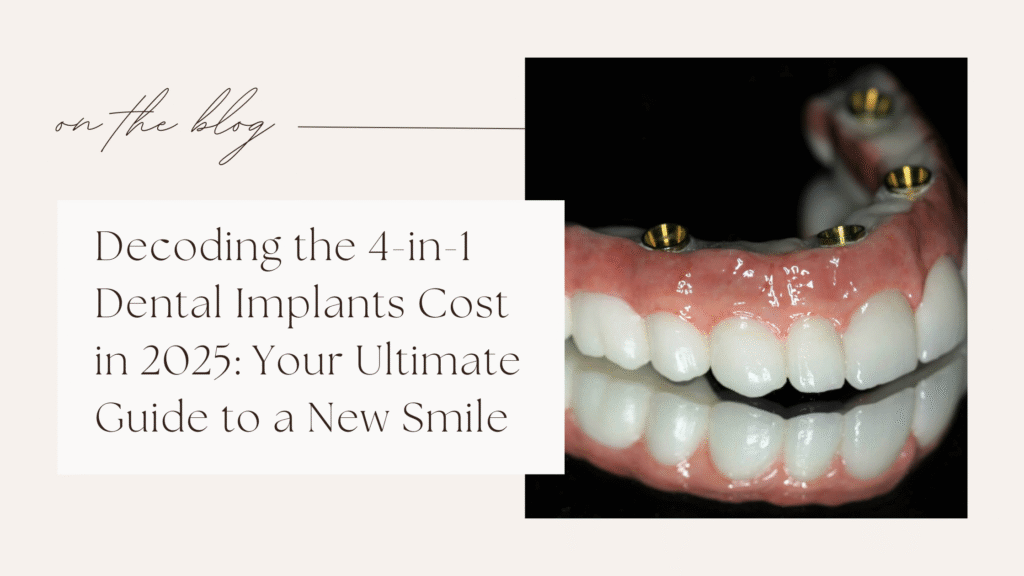Decoding the 4-in-1 Dental Implants Cost in 2025: Your Ultimate Guide to a New Smile