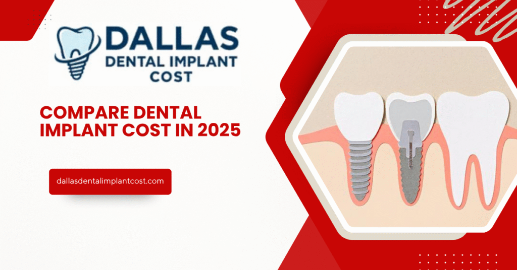 Compare Dental Implant Cost in 2025