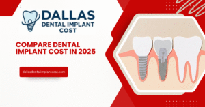 Compare Dental Implant Cost in 2025