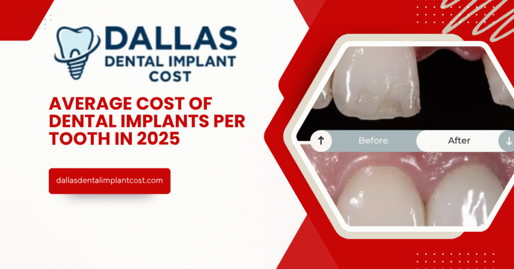 Average Cost of Dental Implants Per Tooth in 2025