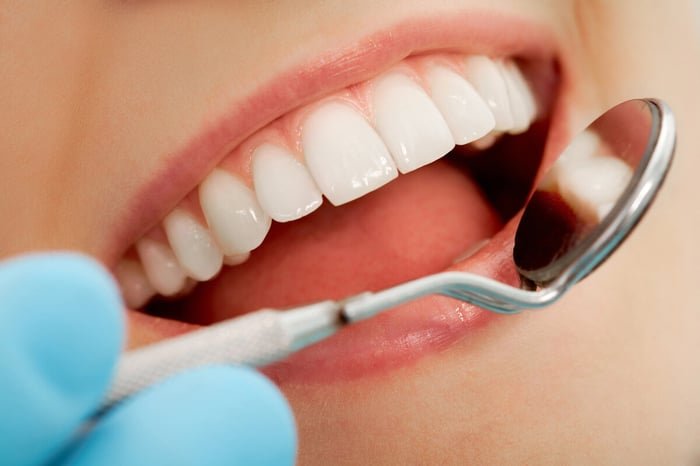 Cost of Dental Implants in Michigan