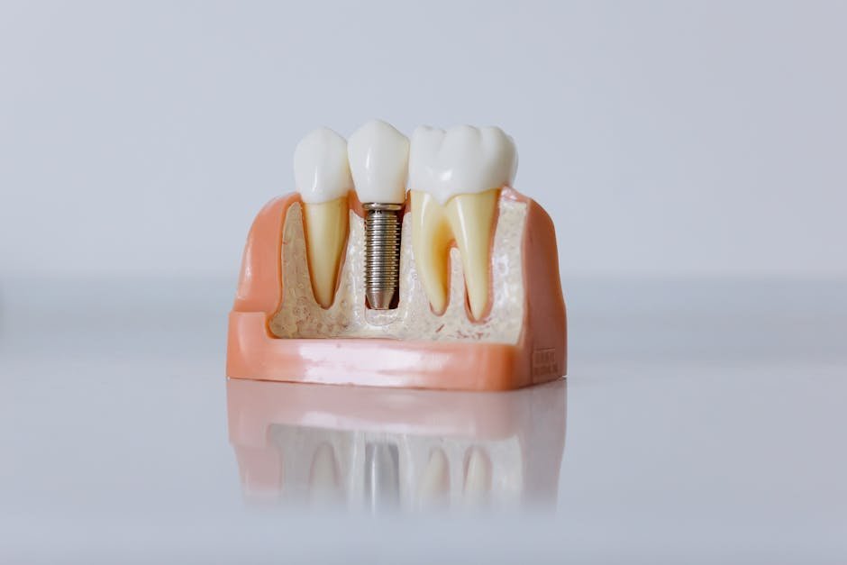 Dental Implant Costs Near Me