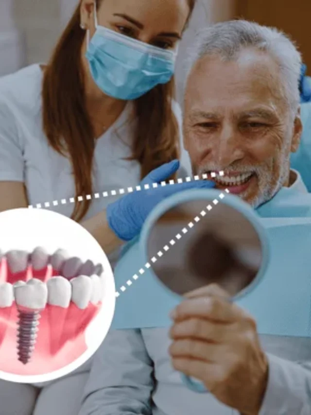 https://dallasdentalimplantcost.com/cost-of-dental-implants-in-the-usa/