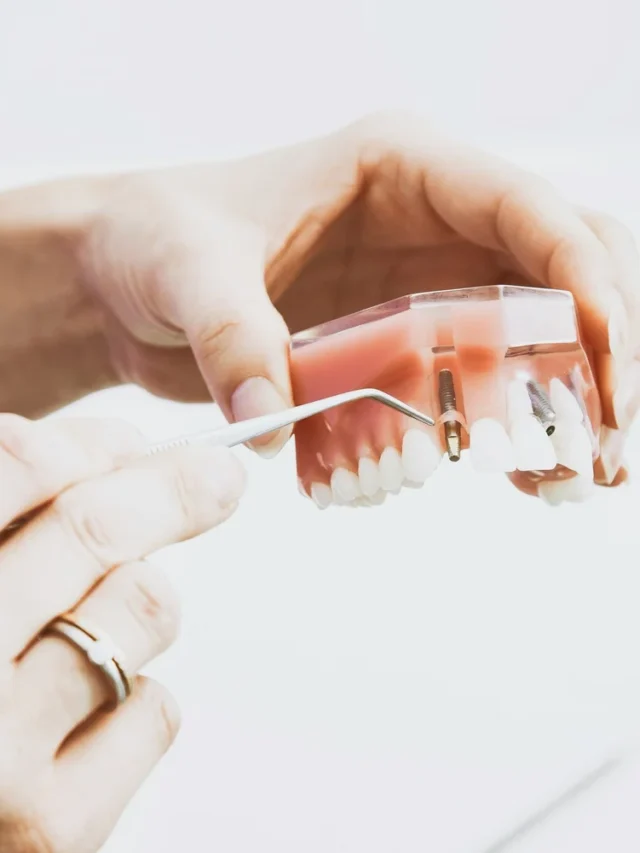 Average Dental Implant Costs