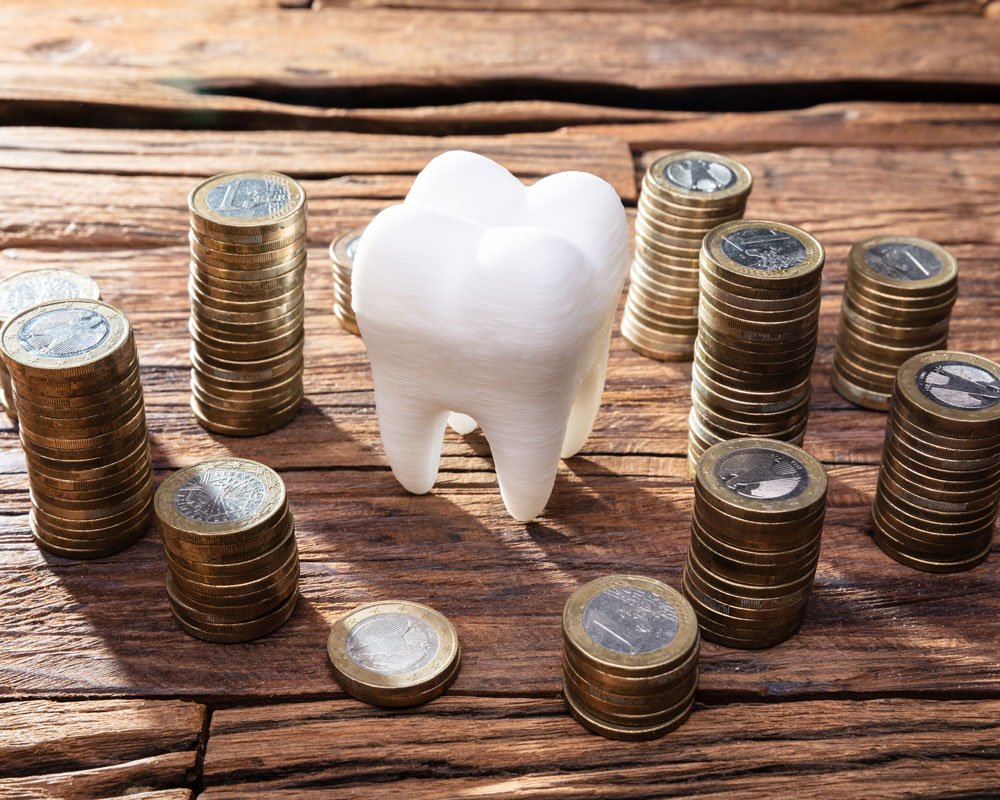 Average Dental Implant Costs