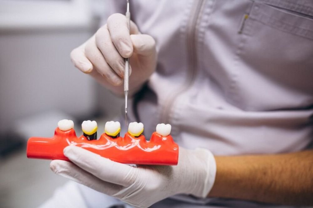 Dental Bridge vs. Implant Cost in 2025