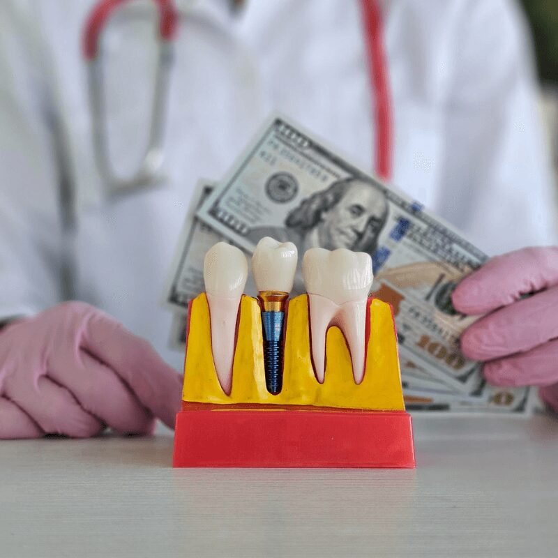 How Much for One Tooth Implant in 2025?