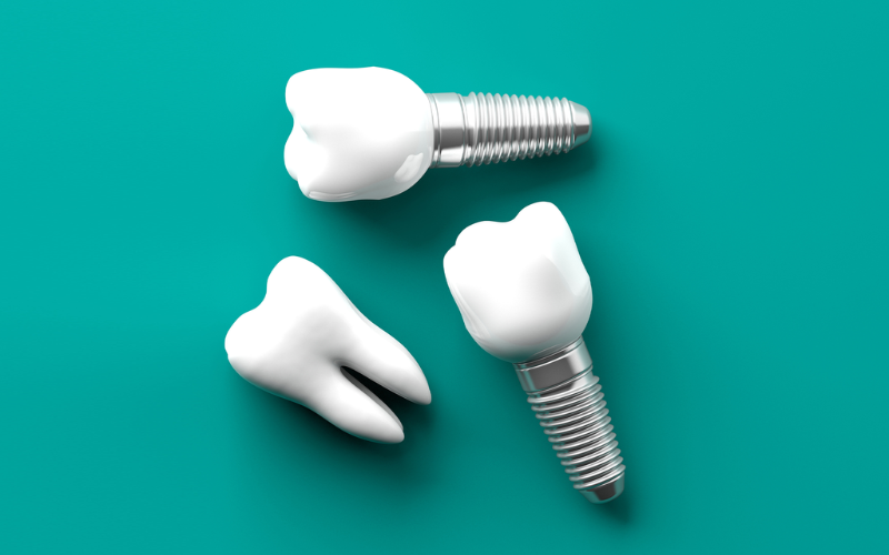 Clear Choice Dental Implants Cost & Reviews