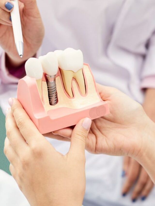 Dental-Implant-Treatment-1
