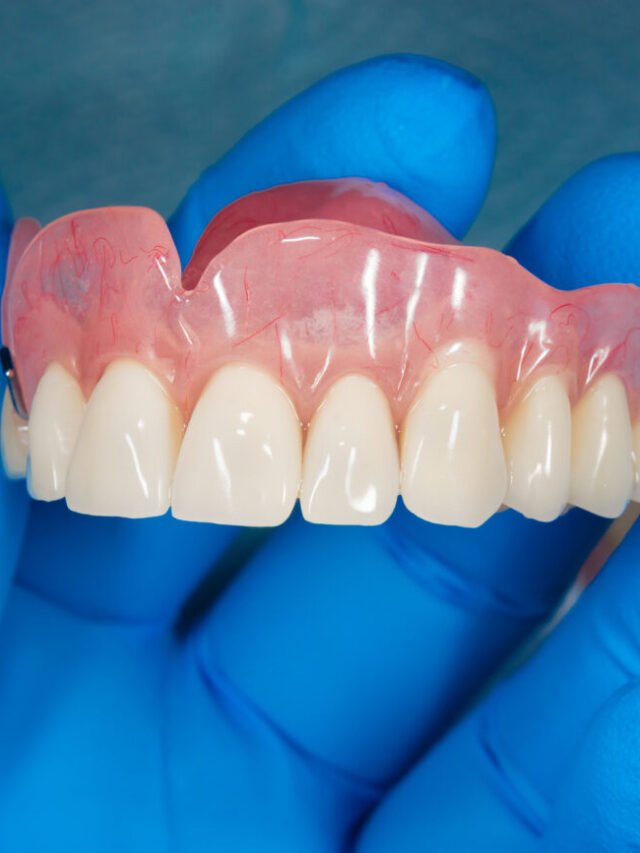 Close-up human denture of the upper jaw on a blue background in the hand of a dentist wearing a medical glove