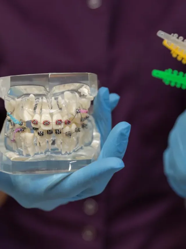 Implant-Tooth-Cost-in-Malaysia-2025-Price-Trends-1280x650.png