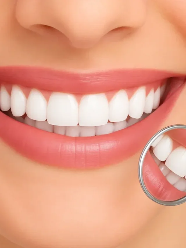 Teeth-Whitening-768x768