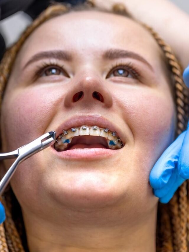 Costa Rica Dental Implant Problems in 2025