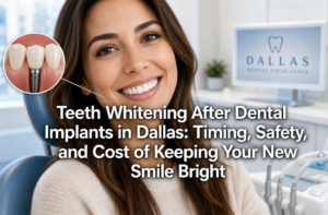 Teeth Whitening After Dental Implants in Dallas: Timing, Safety, and Cost of Keeping Your New Smile Bright