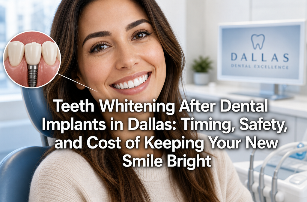 Teeth Whitening After Dental Implants in Dallas: Timing, Safety, and Cost of Keeping Your New Smile Bright
